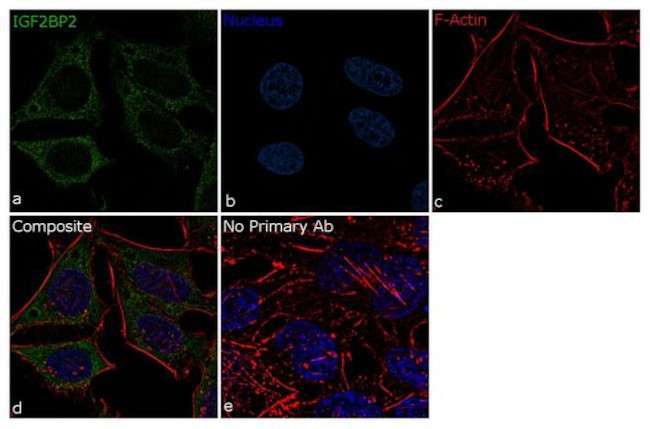 IGF2BP1 Antibody in Immunocytochemistry (ICC/IF)