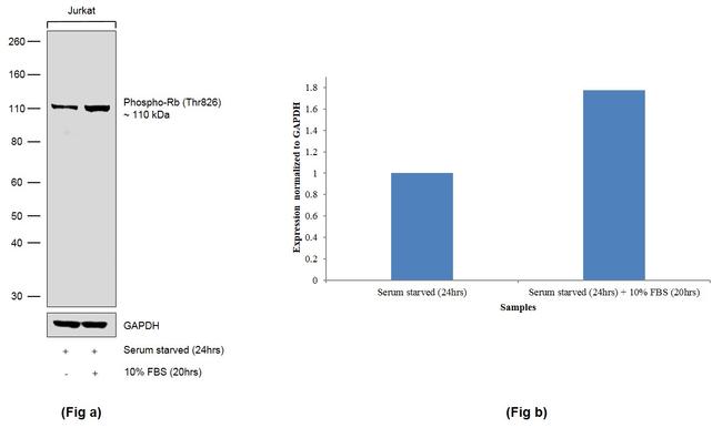 Phospho-Rb (Thr826) Antibody