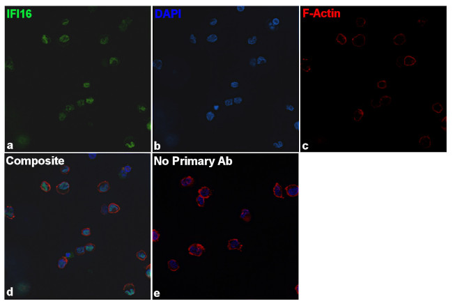 IFI16 Antibody in Immunocytochemistry (ICC/IF)