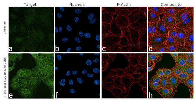 ZBP1 Antibody in Immunocytochemistry (ICC/IF)