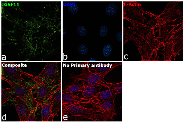 IGSF11 Antibody in Immunocytochemistry (ICC/IF)