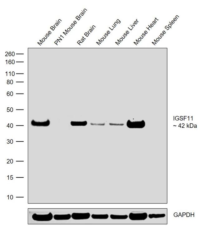 IGSF11 Antibody in Western Blot (WB)