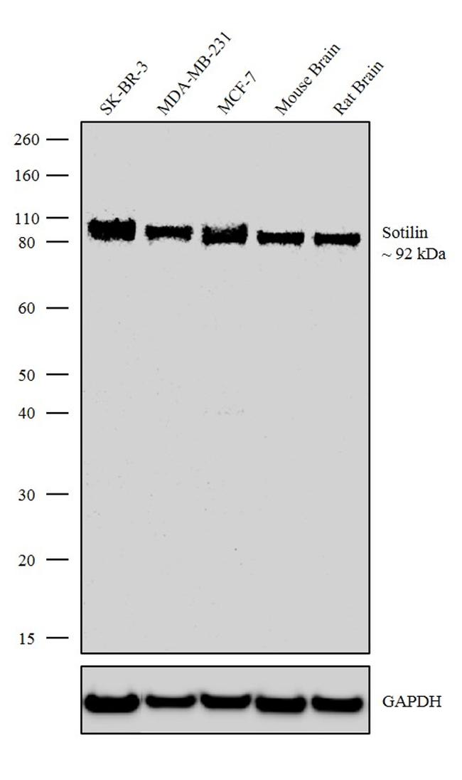 Sortilin Antibody in Western Blot (WB)