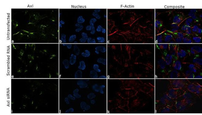 Axl Antibody in Immunocytochemistry (ICC/IF)