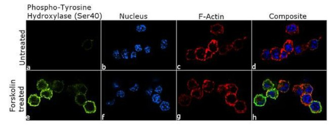 Phospho-Tyrosine Hydroxylase (Ser40) Antibody in Immunocytochemistry (ICC/IF)