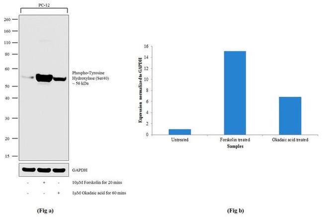 Phospho-Tyrosine Hydroxylase (Ser40) Antibody in Western Blot (WB)