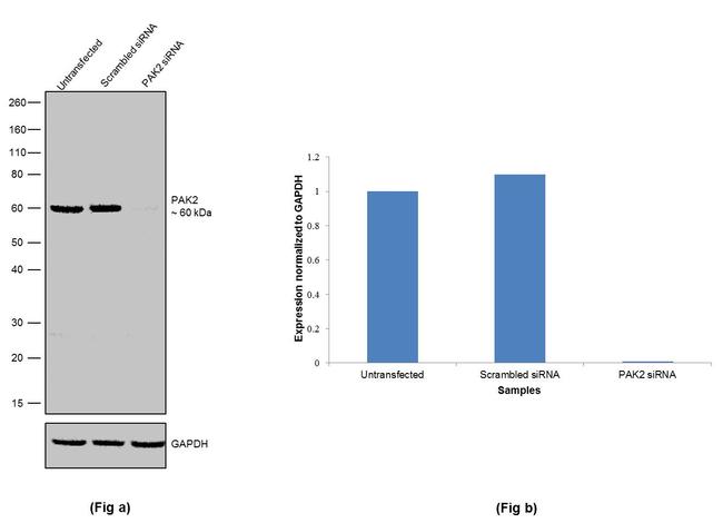 PAK2 Antibody in Western Blot (WB)