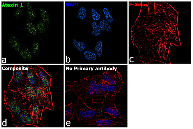 Ataxin 1 Antibody in Immunocytochemistry (ICC/IF)