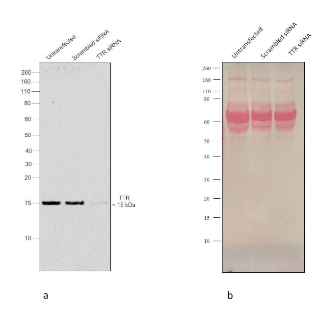 Transthyretin Antibody