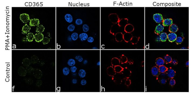 TIM-1 Antibody in Immunocytochemistry (ICC/IF)