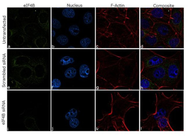 eIF4B Antibody in Immunocytochemistry (ICC/IF)