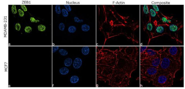 ZEB1 Antibody