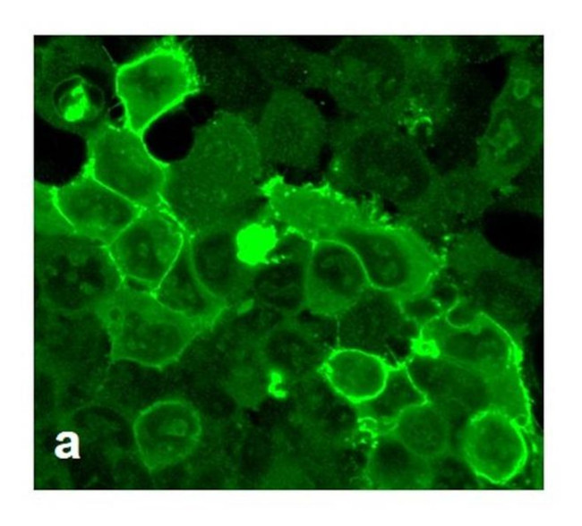 GABBR2 Antibody in Immunocytochemistry (ICC/IF)