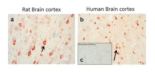 GABBR2 Antibody in Immunohistochemistry (IHC)