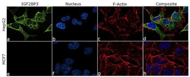 IGF2BP3 Antibody in Immunocytochemistry (ICC/IF)