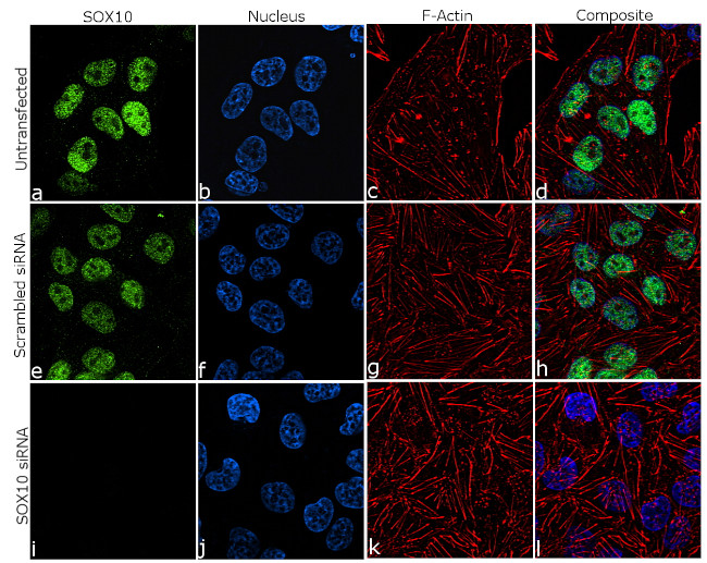 SOX10 Antibody in Immunocytochemistry (ICC/IF)