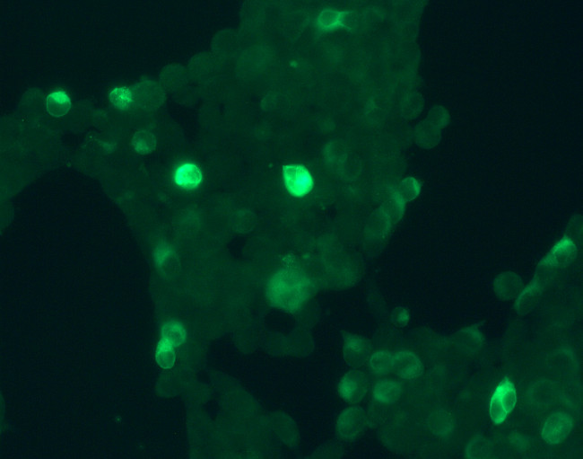 GPR30 Antibody in Immunocytochemistry (ICC/IF)