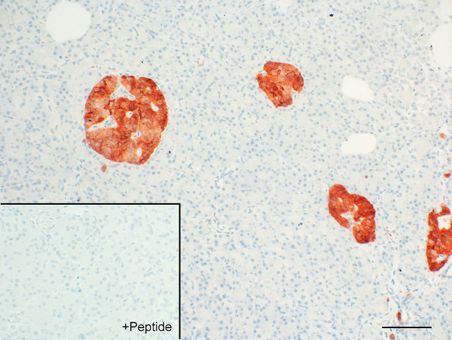 GPR30 Antibody