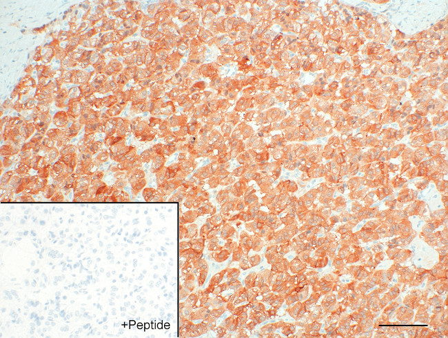 GPR30 Antibody in Immunohistochemistry (IHC)