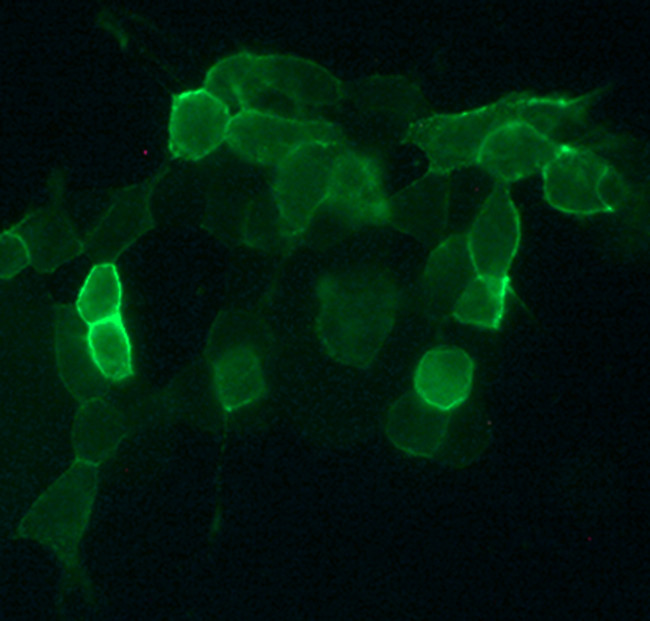 CNR2 Antibody in Immunocytochemistry (ICC/IF)