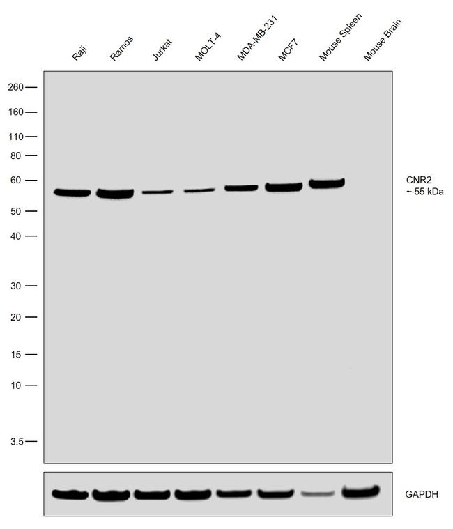 CNR2 Antibody in Western Blot (WB)