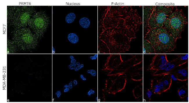 PRMT6 Antibody in Immunocytochemistry (ICC/IF)