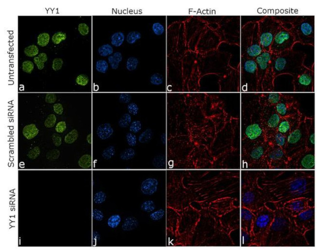 YY1 Antibody in Immunocytochemistry (ICC/IF)