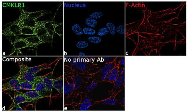 CMKLR1 Antibody in Immunocytochemistry (ICC/IF)