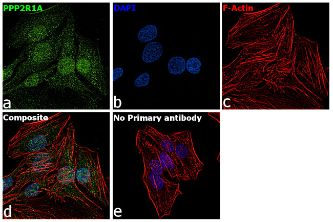 PPP2R1A Antibody in Immunocytochemistry (ICC/IF)