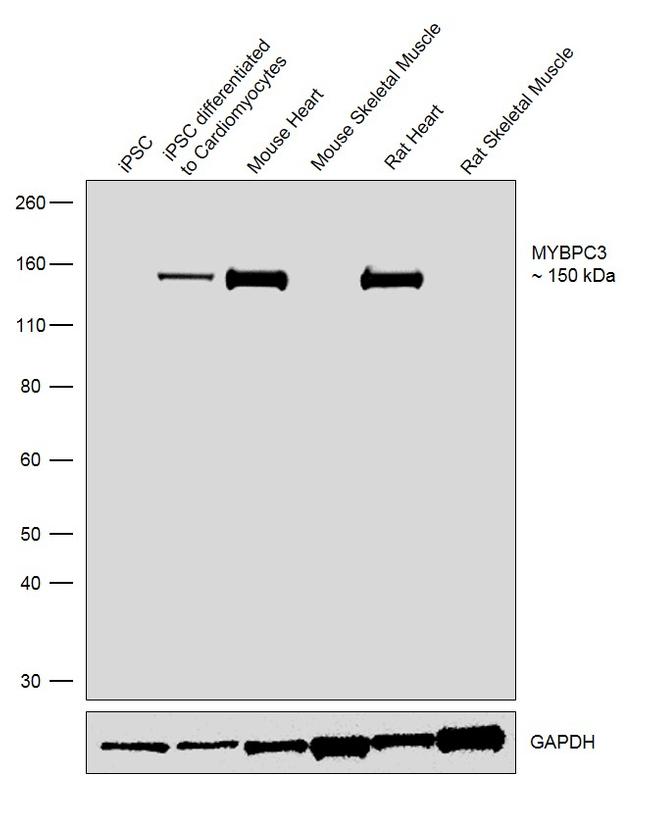 MYBPC3 Antibody in Western Blot (WB)