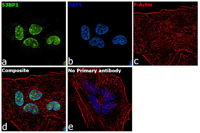 53BP1 Antibody in Immunocytochemistry (ICC/IF)