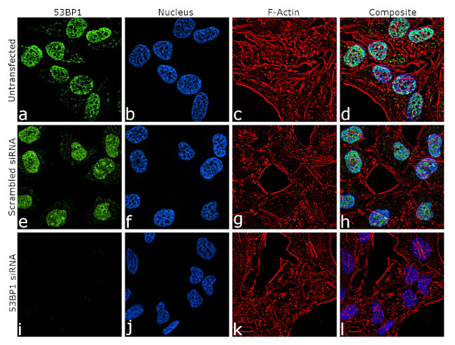 53BP1 Antibody