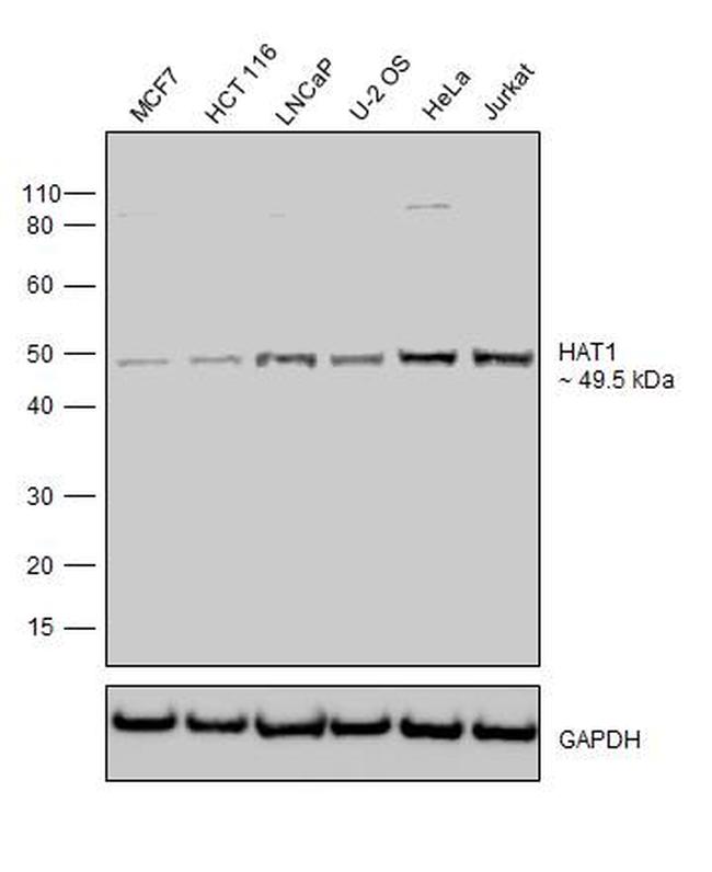 HAT1 Antibody in Western Blot (WB)