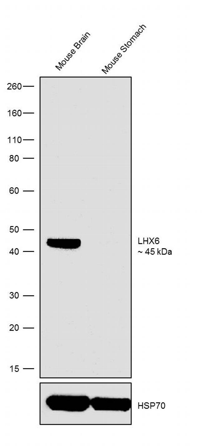 LHX6 Antibody in Western Blot (WB)