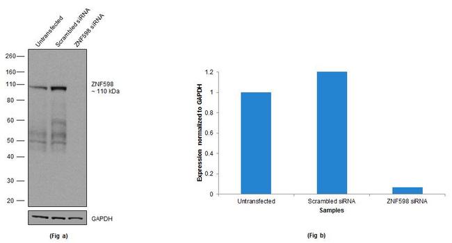 ZNF598 Antibody in Western Blot (WB)