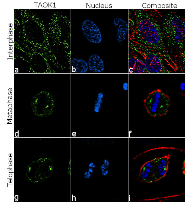 TAOK1 Antibody in Immunocytochemistry (ICC/IF)