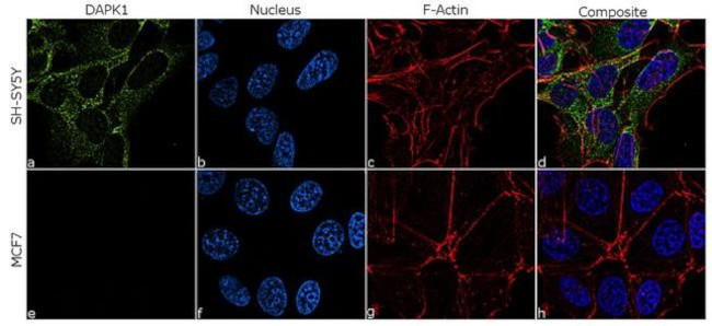 DAPK1 Antibody in Immunocytochemistry (ICC/IF)