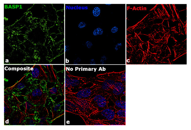 BASP1 Antibody in Immunocytochemistry (ICC/IF)