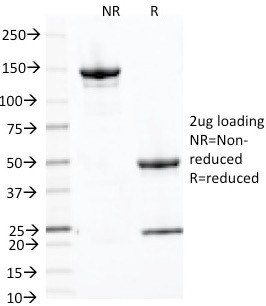 CD71/Transferrin Receptor (TFRC) Antibody in SDS-PAGE (SDS-PAGE)