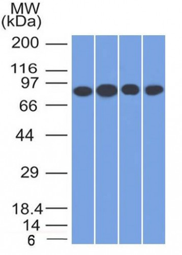 CD71/Transferrin Receptor (TFRC) (Extracellular Domain) Antibody in Western Blot (WB)