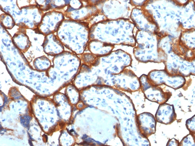 CD71/Transferrin Receptor (TFRC) (Extracellular Domain) Antibody in Immunohistochemistry (Paraffin) (IHC (P))