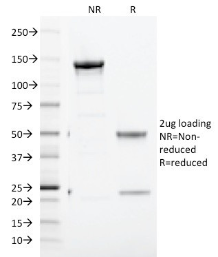 CD71/Transferrin Receptor (TFRC) (Extracellular Domain) Antibody in SDS-PAGE (SDS-PAGE)