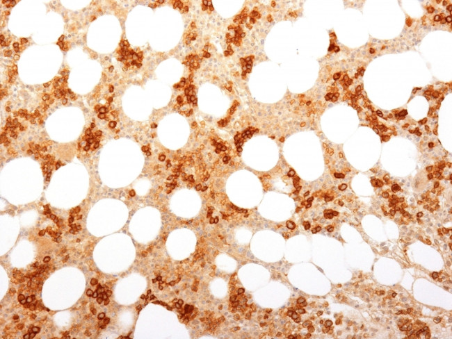 CD71/Transferrin Receptor (TFRC) (Extracellular Domain) Antibody in Immunohistochemistry (Paraffin) (IHC (P))