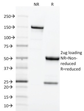 CD71/Transferrin Receptor (TFRC) (Extracellular Domain) Antibody in SDS-PAGE (SDS-PAGE)