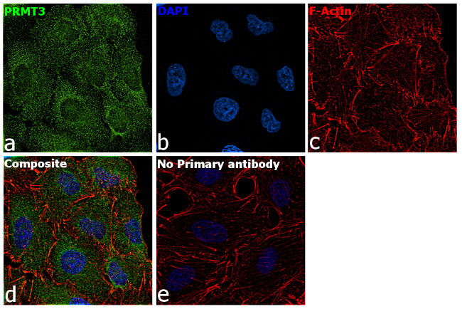 PRMT3 Antibody in Immunocytochemistry (ICC/IF)