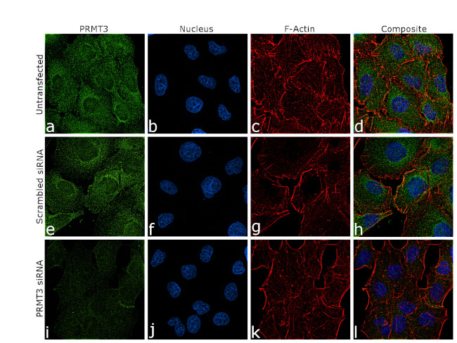 PRMT3 Antibody in Immunocytochemistry (ICC/IF)