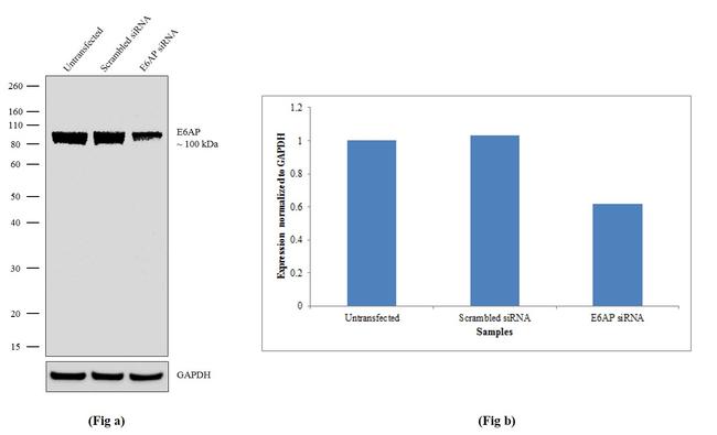 E6AP Antibody in Western Blot (WB)