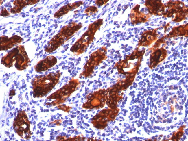 Thyroglobulin (Thyroidal Cell Marker) Antibody in Immunohistochemistry (Paraffin) (IHC (P))