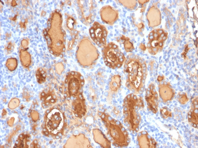 Thyroglobulin (Thyroidal Cell Marker) Antibody in Immunohistochemistry (Paraffin) (IHC (P))