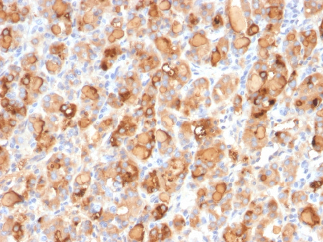 Thyroglobulin (Thyroidal Cell Marker) Antibody in Immunohistochemistry (Paraffin) (IHC (P))